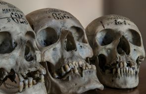 Tobacco Turns Your Bones to Dust—New Shocking Study Reveals Smoking 